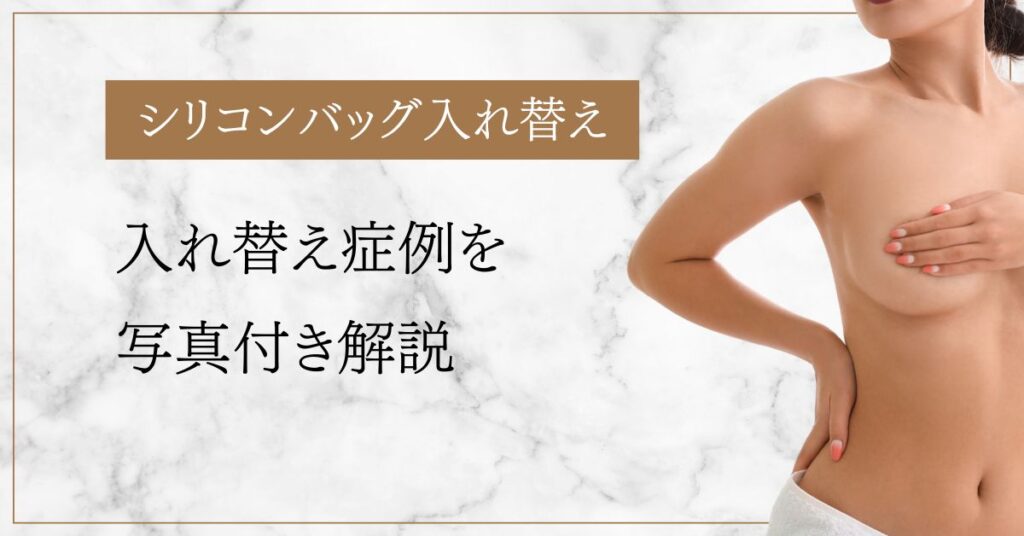 シリコンバッグ入れ替え症例