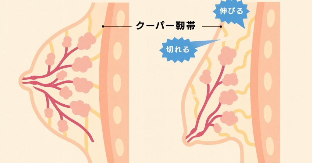 クーパー靭帯