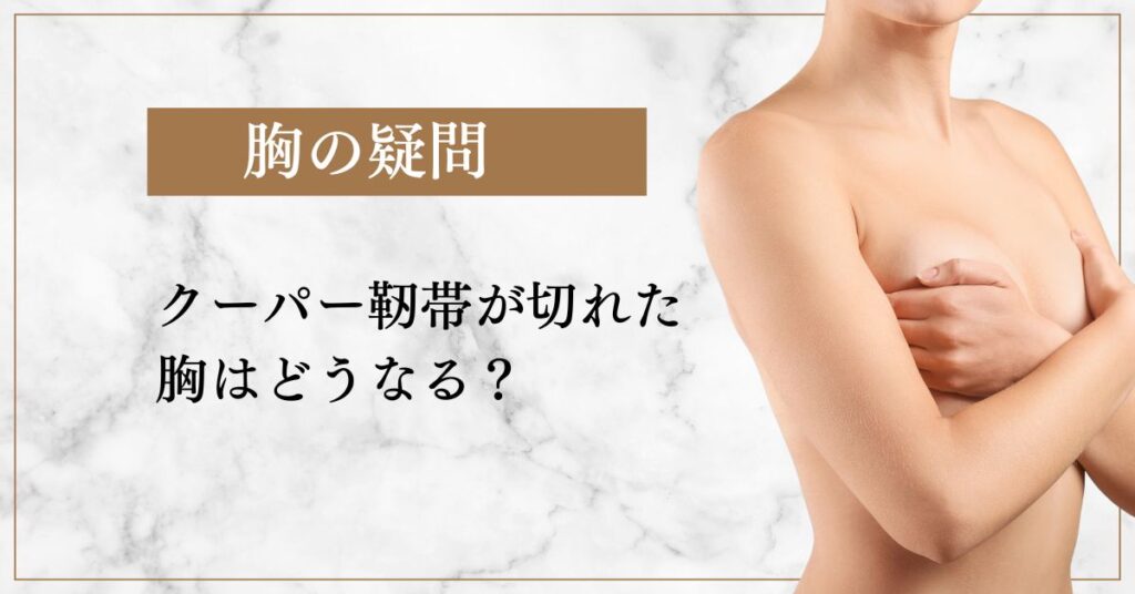 クーパー靭帯が切れた胸はどうなる？下垂した胸は元に戻るのか