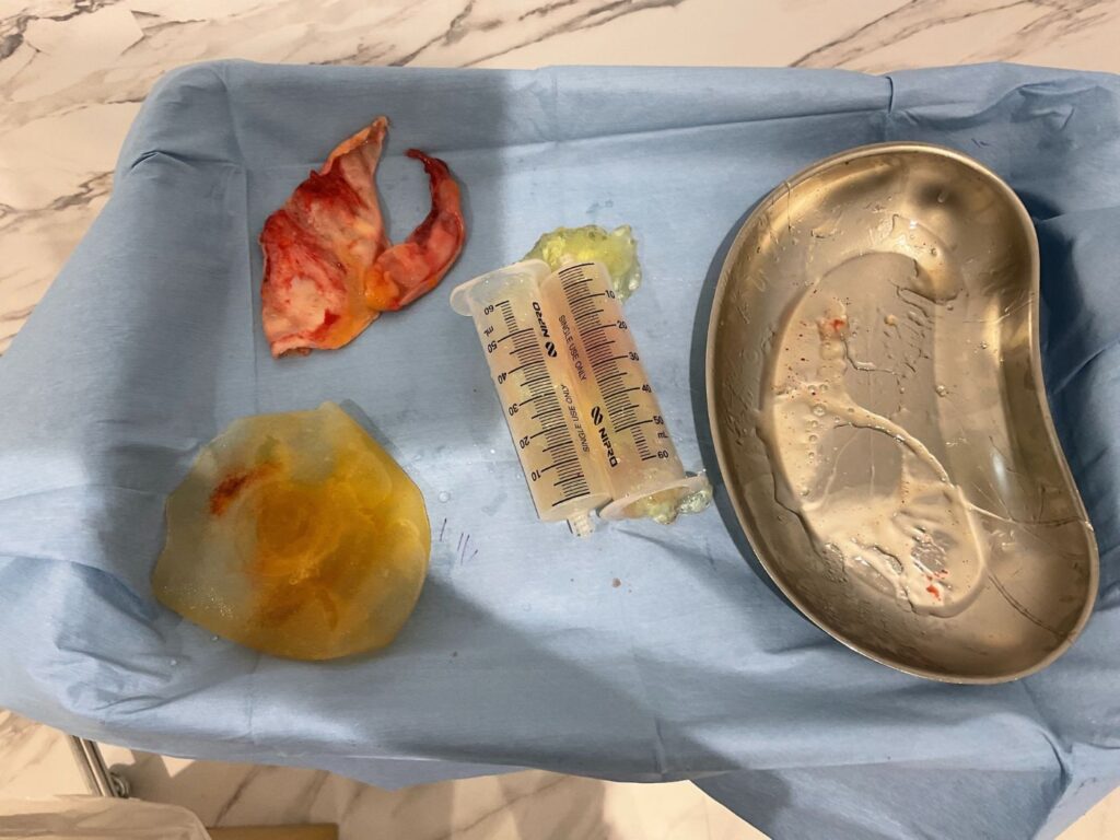 被膜処理のイメージ