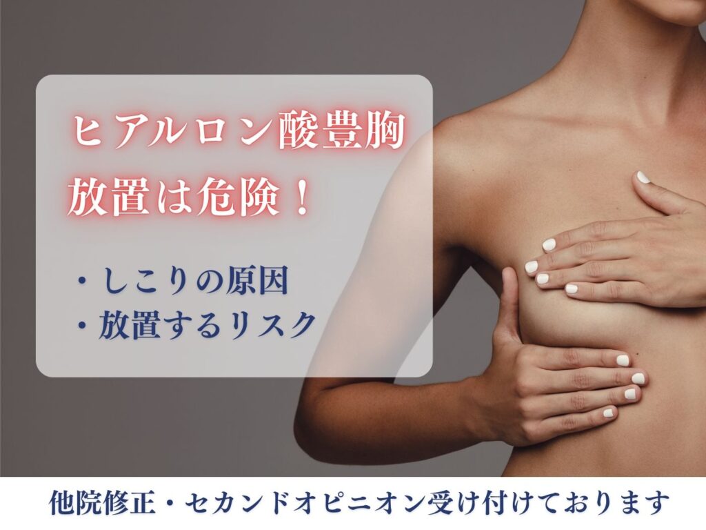 ヒアルロン酸豊胸 しこり (1)