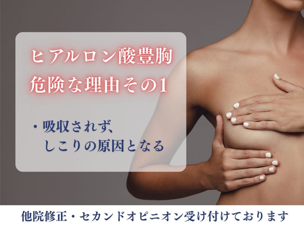ヒアルロン酸豊胸 吸収