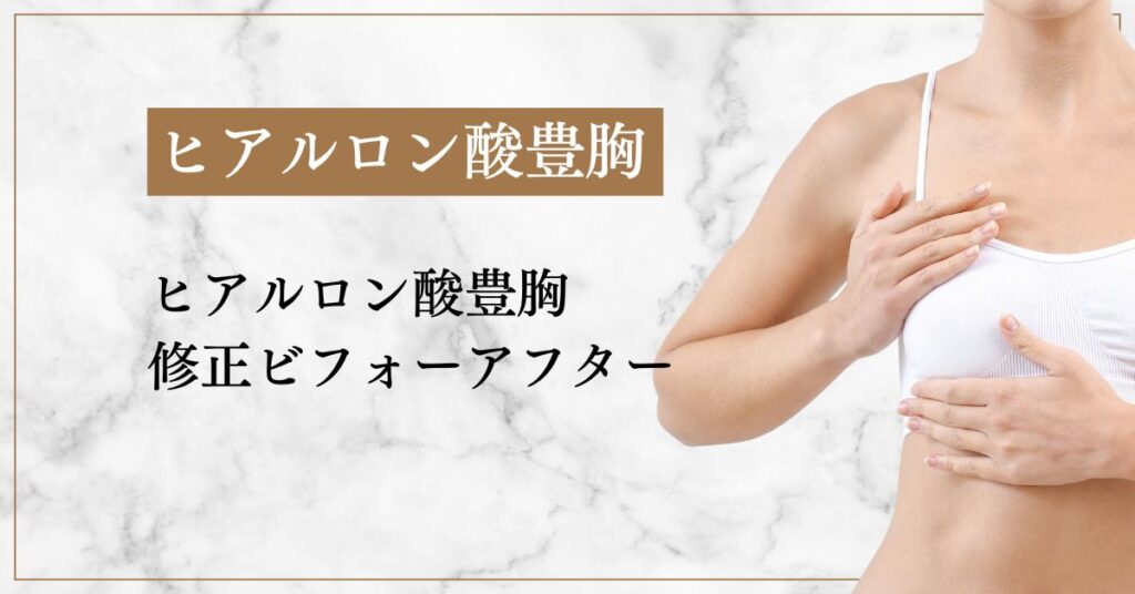 ヒアルロン酸豊胸の修正ビフォーアフター