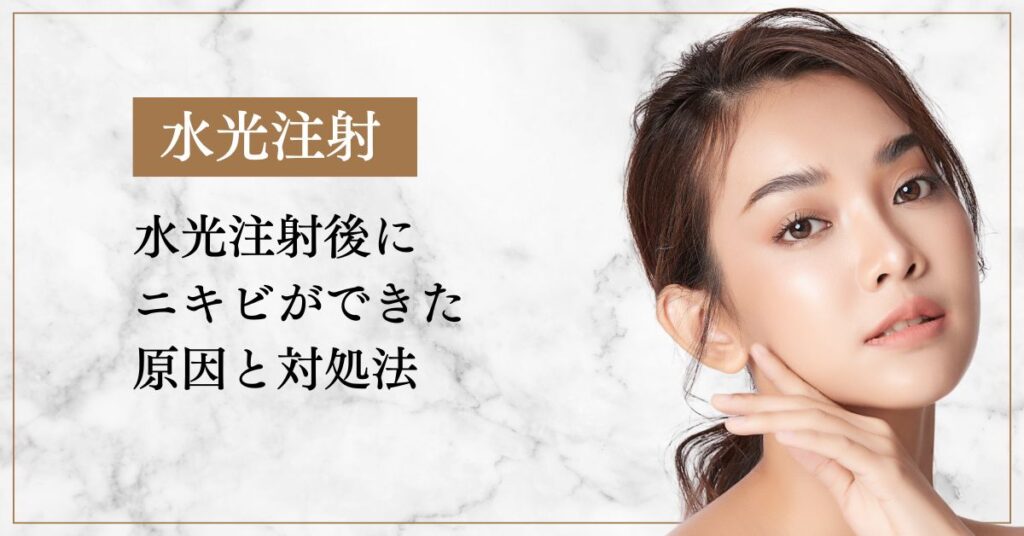 水光注射後にニキビができた原因と対処法・予防策も解説