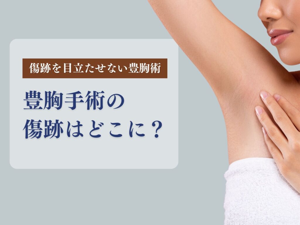 豊胸手術 跡