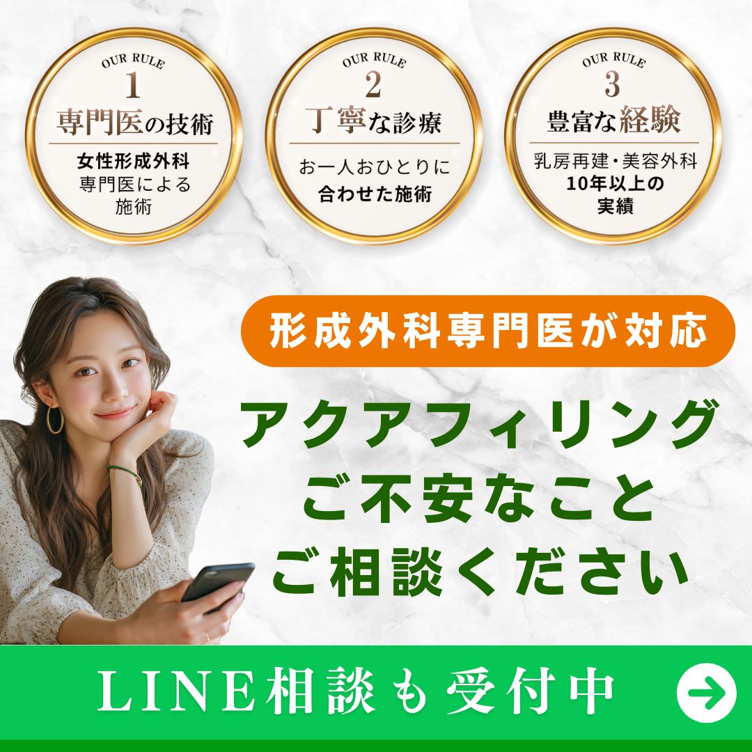 アクアフィリング離脱防止バナー