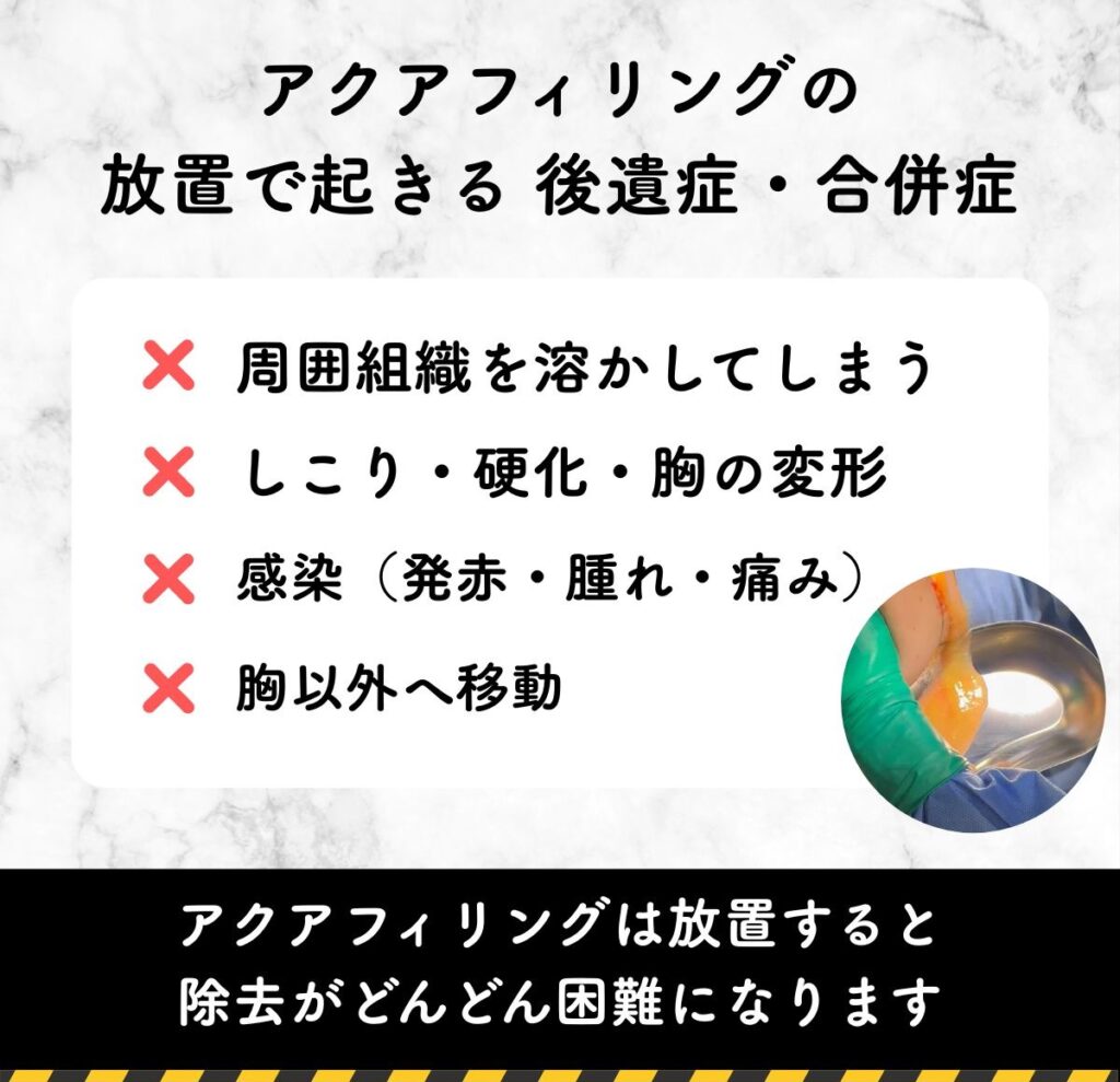 アクアフィリングの後遺症と合併症