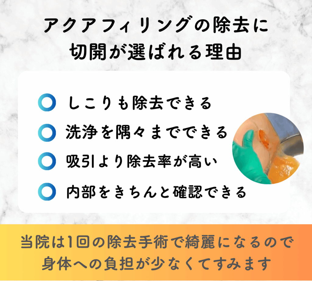 アクアフィリングの除去に切開が選ばれる理由