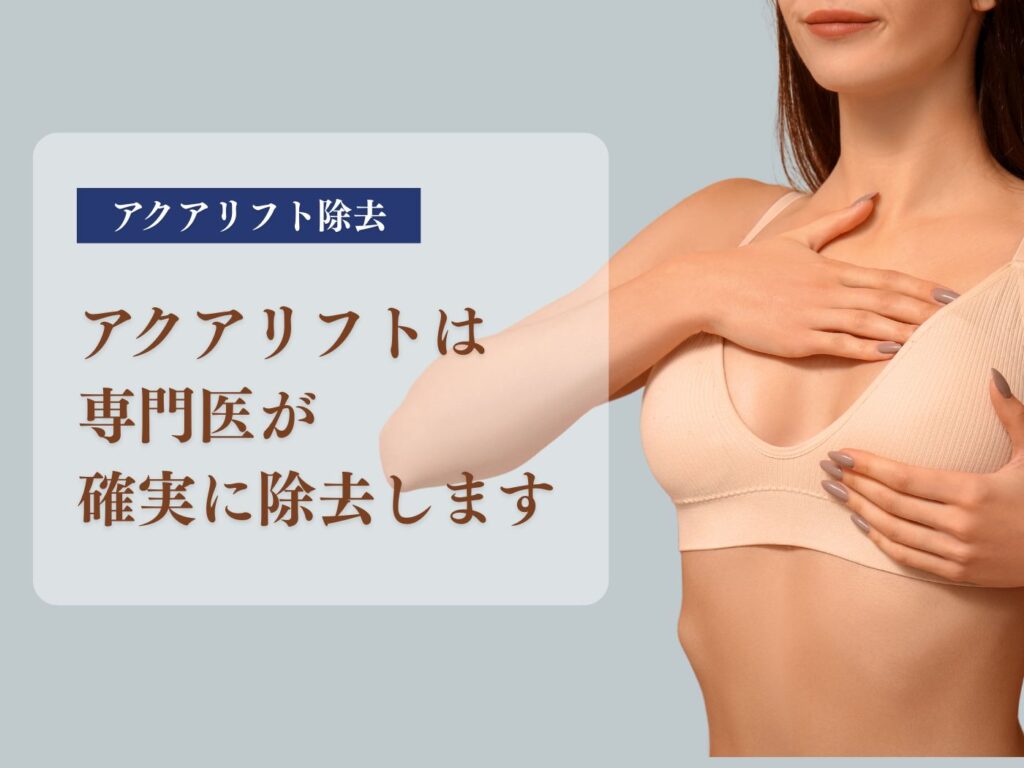 アクアリフト除去