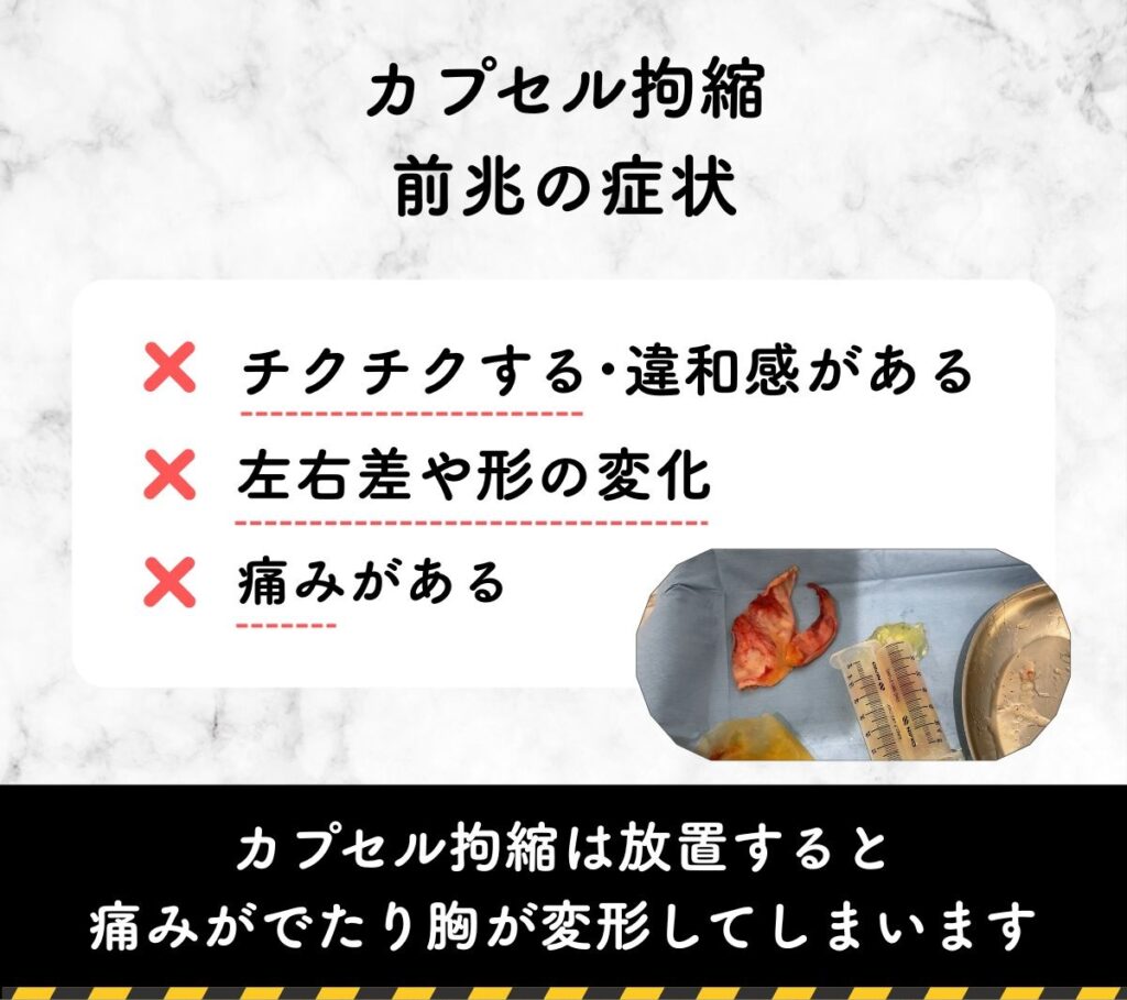 カプセル拘縮の症状
