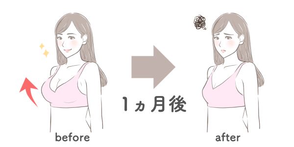 ヒアルロン酸豊胸　減った
