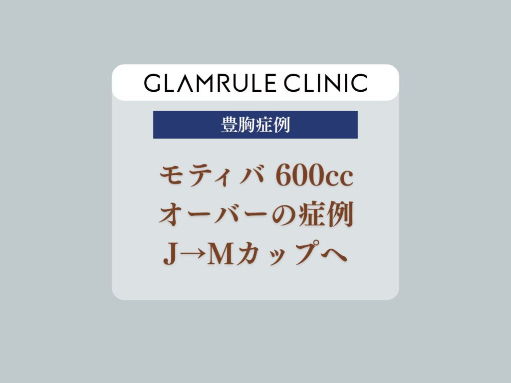 モティバ600cc
