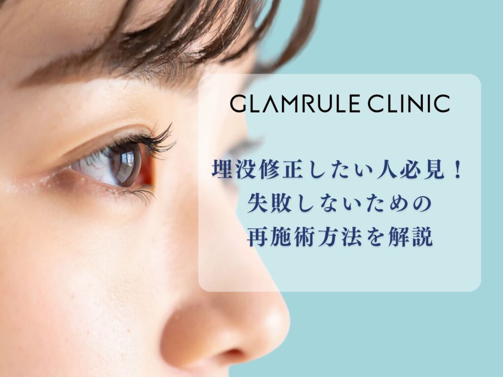 埋没 修正 したい