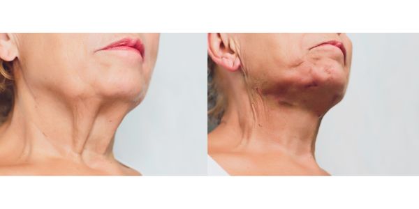 糸が切れた・ずれたときの見た目や感覚の変化