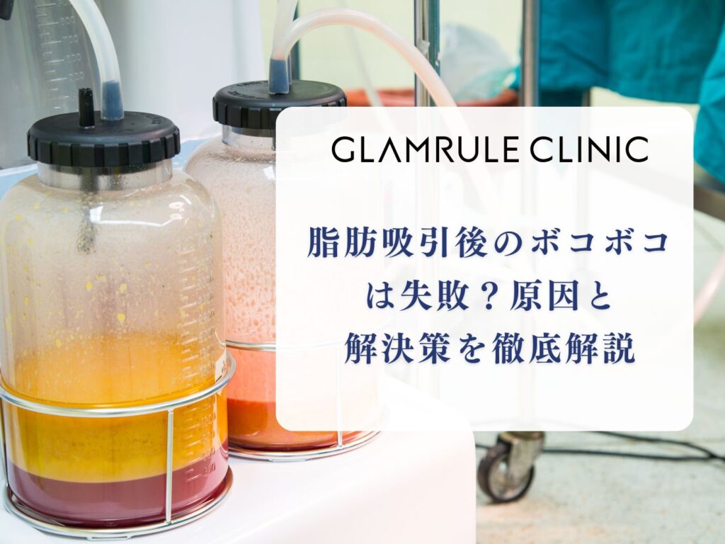 脂肪吸引 ボコボコ