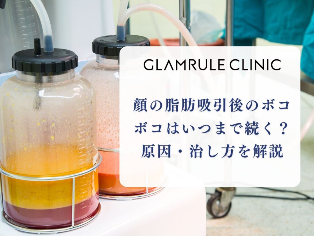 脂肪吸引 ボコボコ いつまで 顔