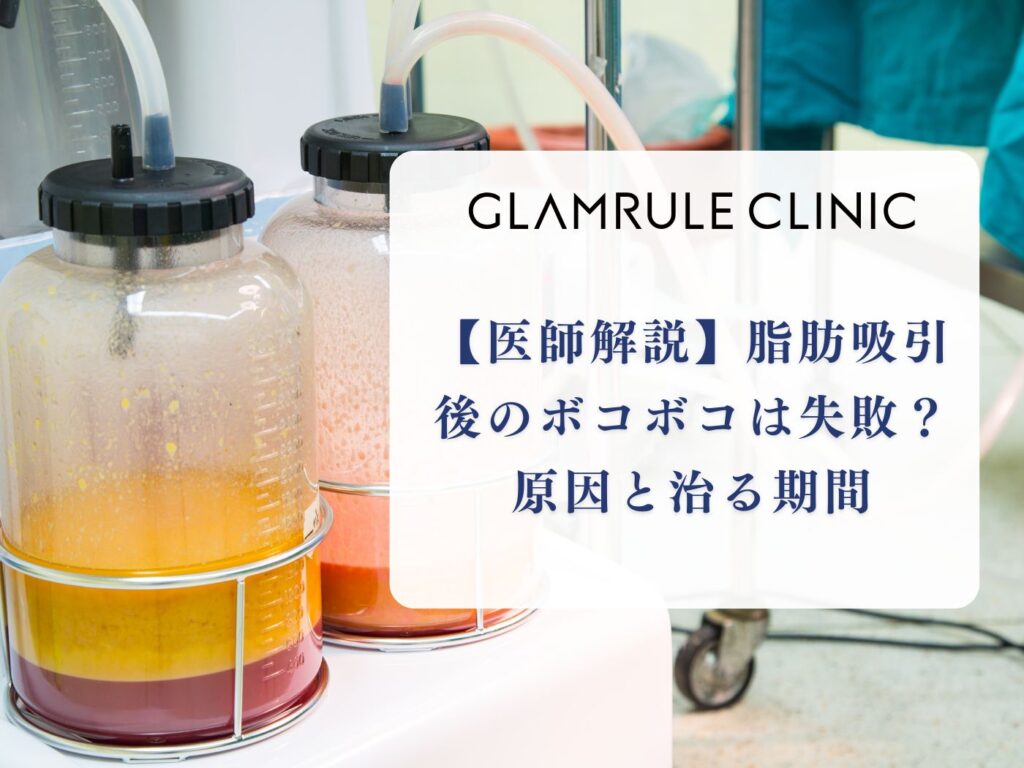 脂肪吸引 ボコボコ 原因