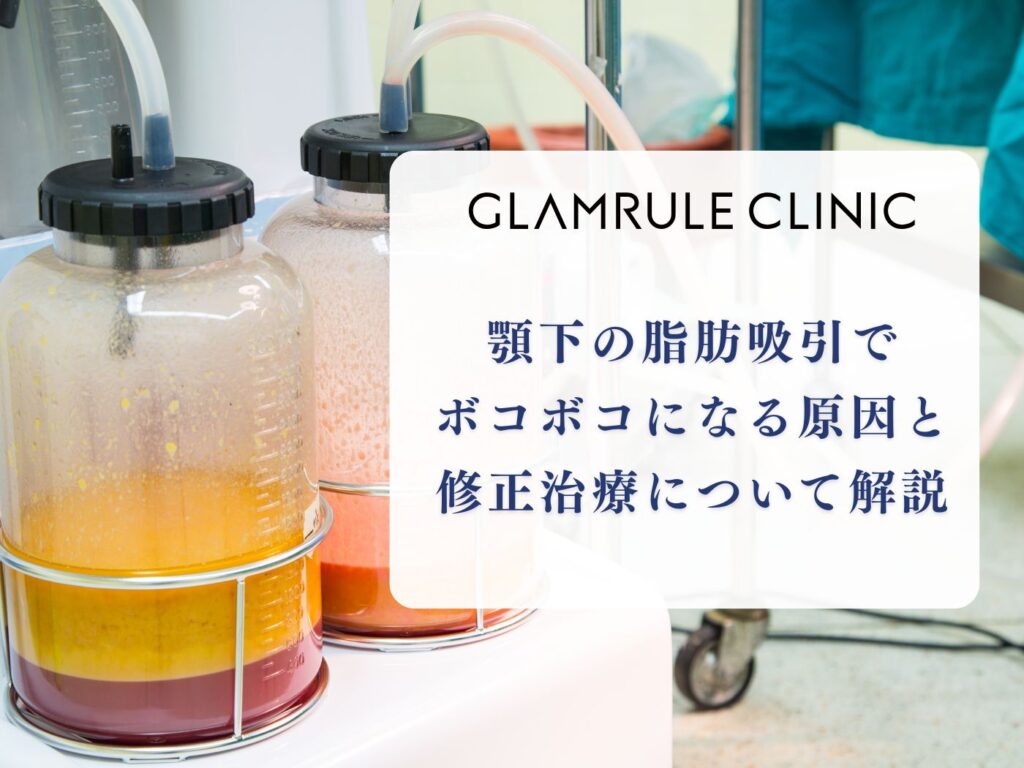 脂肪吸引 ボコボコ 顎下