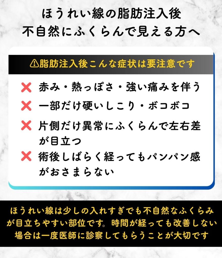 ほうれい線 脂肪注入 入れすぎ