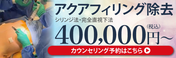 アクアフィリング除去カウンセリング予約