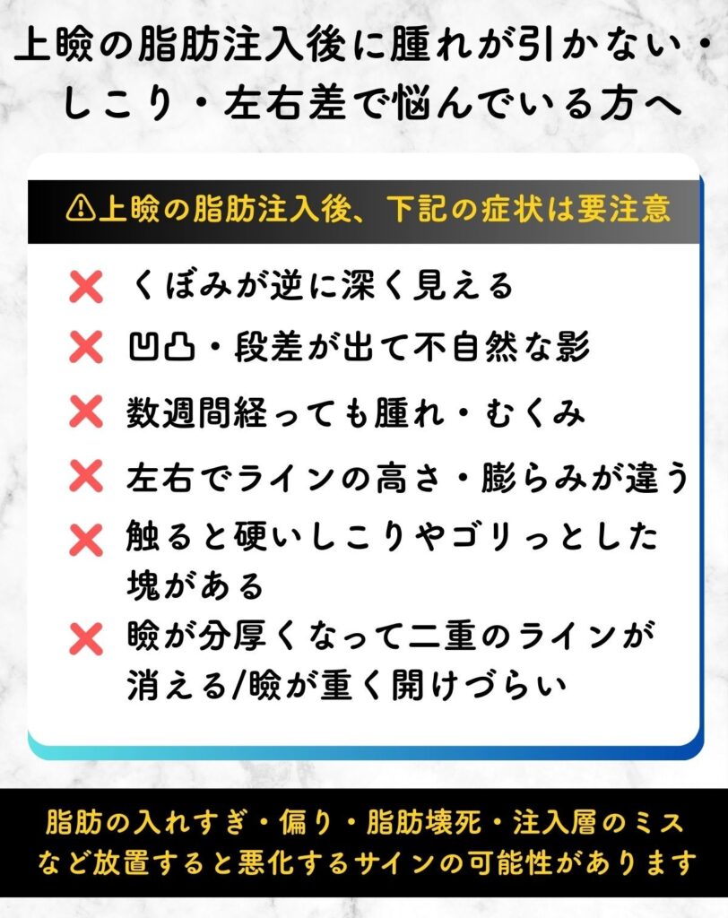 上瞼 脂肪注入 失敗