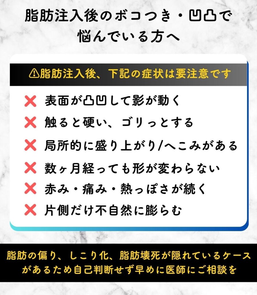 脂肪注入 ボコつき