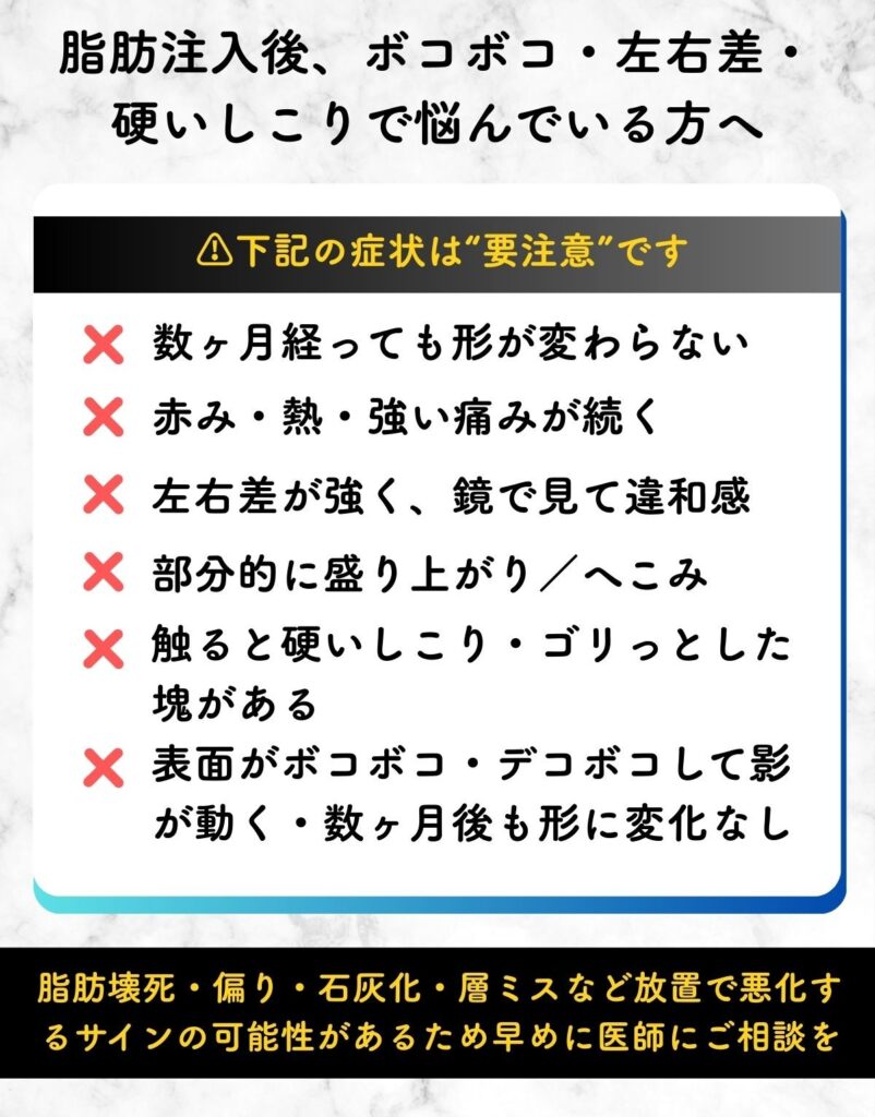 脂肪注入 失敗