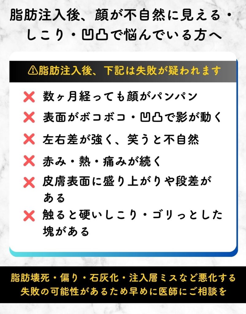 脂肪注入 失敗 顔