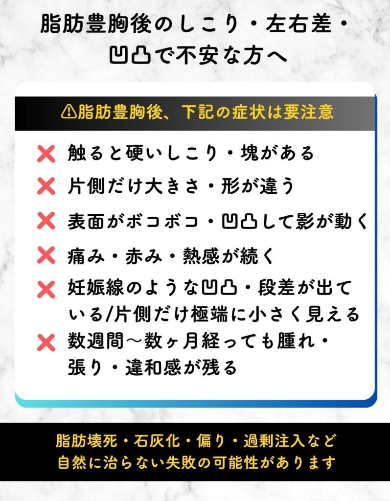 脂肪注入 豊胸 失敗