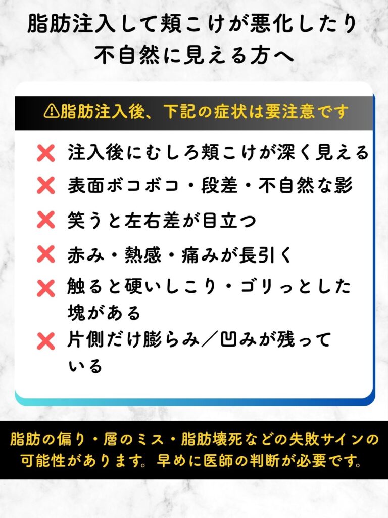 頬こけ 脂肪注入 失敗