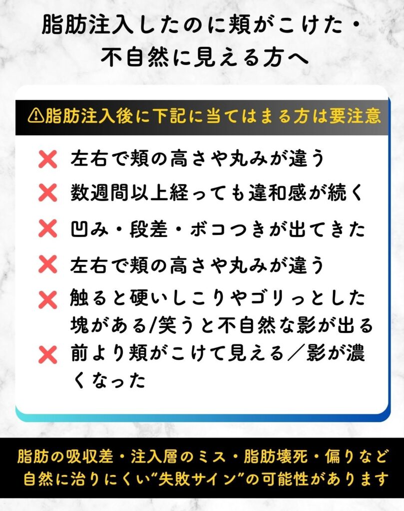 頬コケ 脂肪注入 失敗
