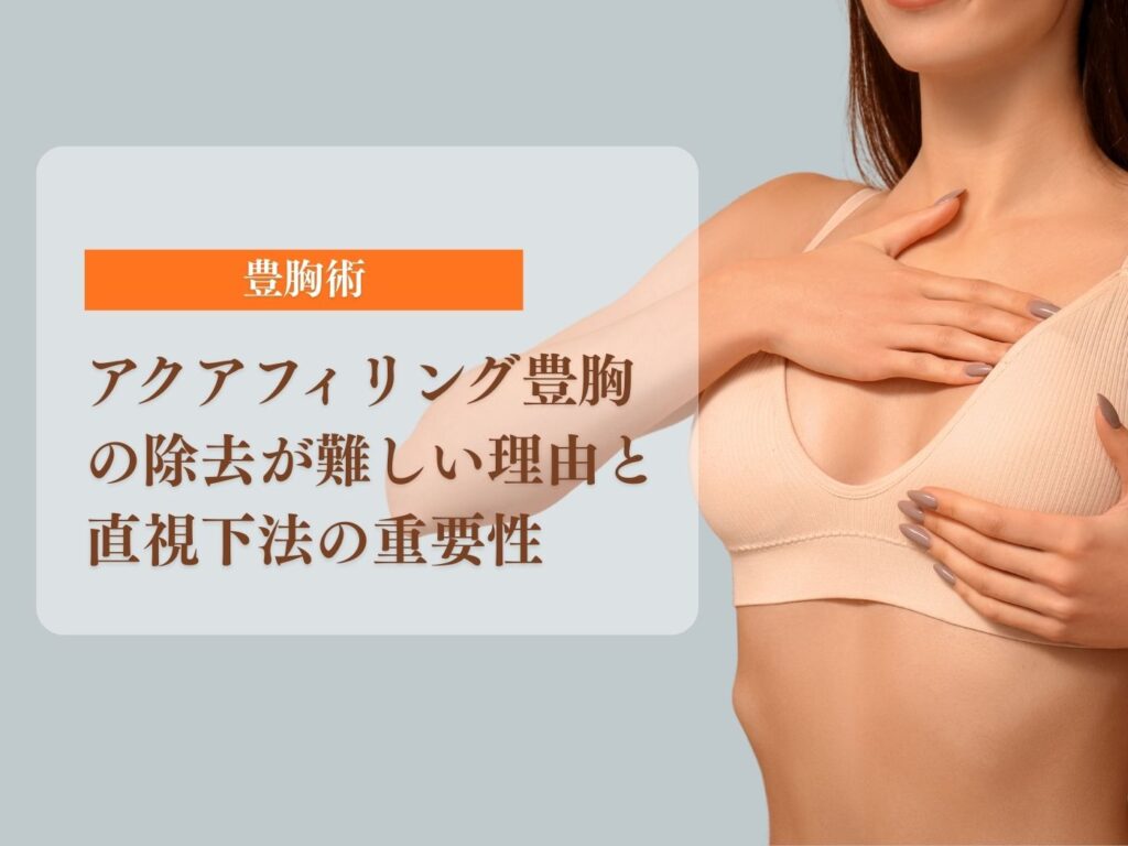アクアフィリング 胸 除去