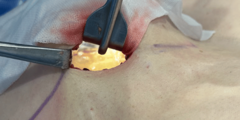 プロセス：見る