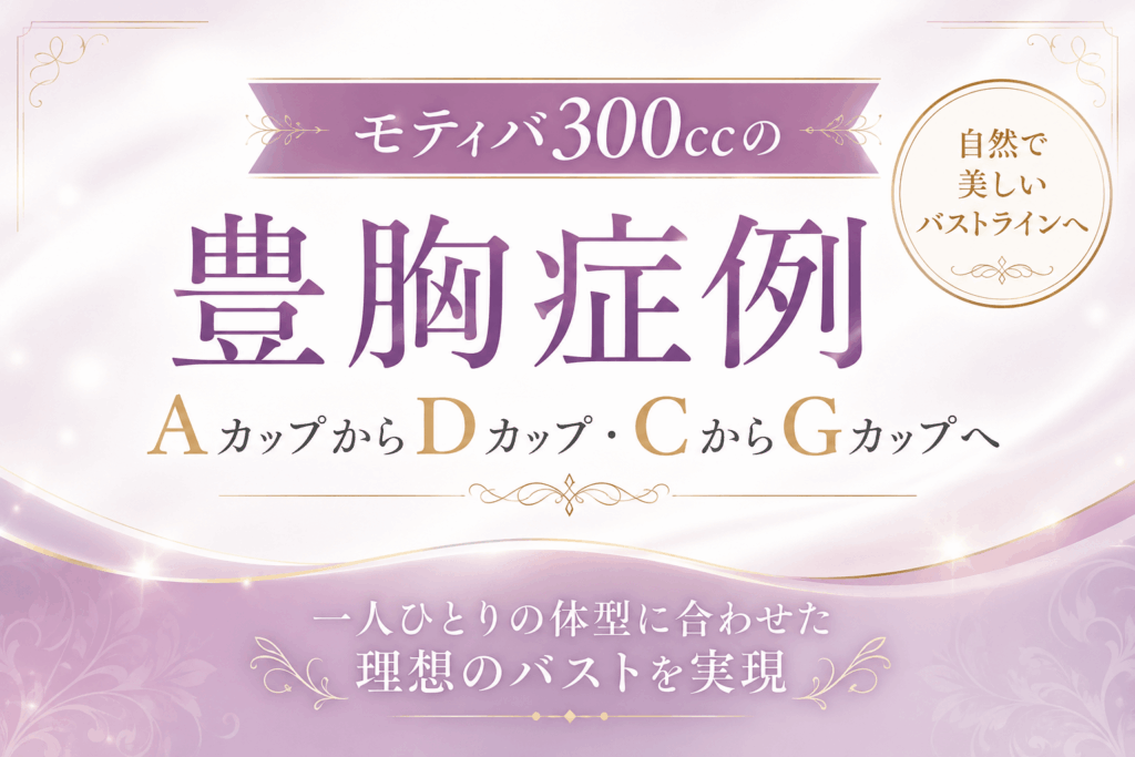 モティバ　300cc