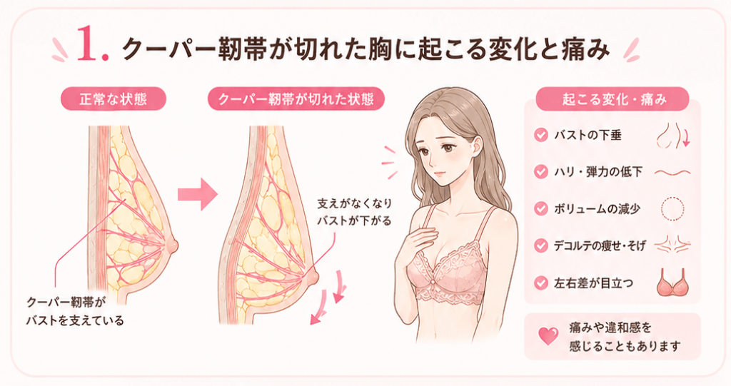 クーパー靭帯が切れた胸に起こる変化と痛み