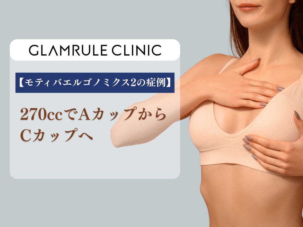 モティバエルゴノミクス2　270cc