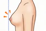 左右の高さが違う
