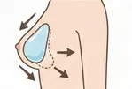 バストラインから移動してきた