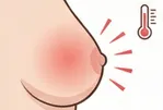 熱感がある