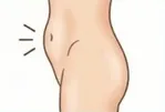 採取できる脂肪が少ない