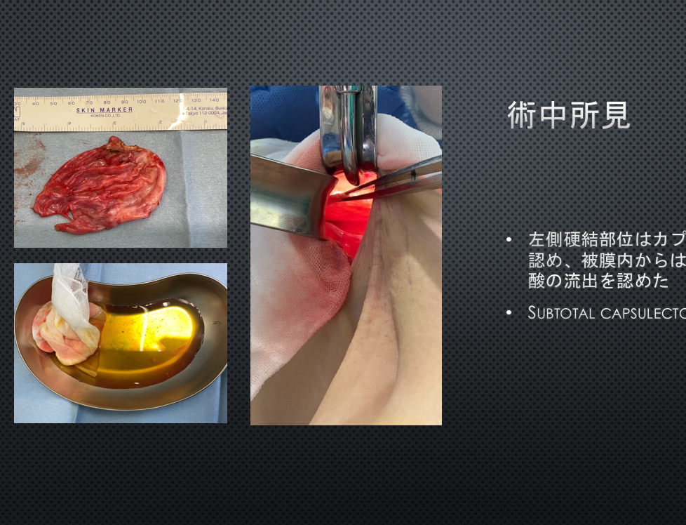 学会発表画像2
