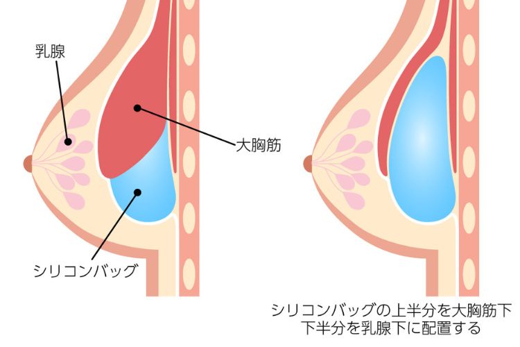 特徴2の画像