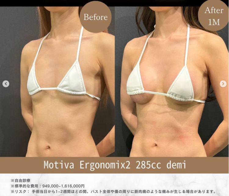 症例4
