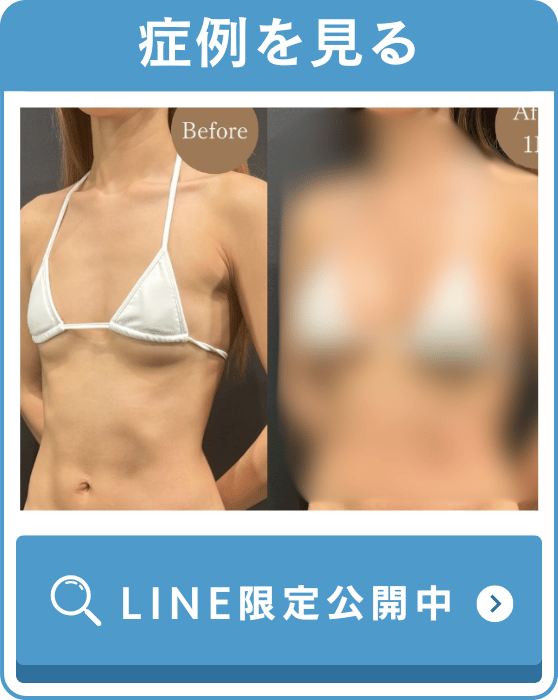 症例を見る